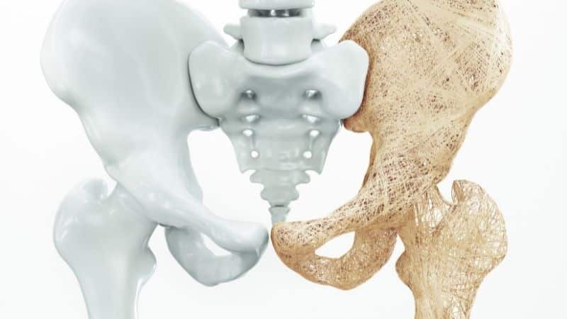 Hip Ostoeporosis
